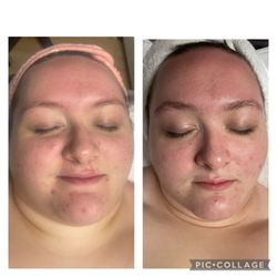 LashOVation - Before and after our signature facelift massage /facial
