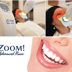 Rivertop Dental - Official ZOOM Whitening In-office Machine