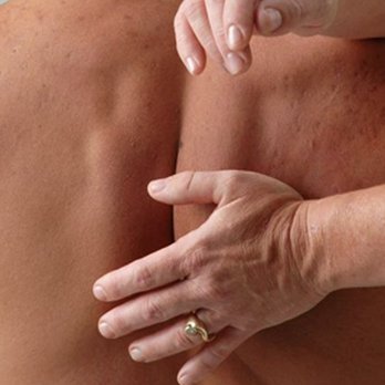 PainRelief Specialists - Rolfing is deep slow hands-on muscle work. People seek Rolfing to ease pain and chronic stress as well as improve performance. - Massage Therapy Near Me - Denver, Colorado PainRelief Specialists - Rolfing is deep slow hands-on muscle work. People seek Rolfing to ease pain and chronic stress as well as improve performance. - Massage Therapy Near Me - Denver, Colorado