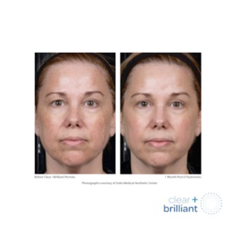 Steven B. Hopping, MD - Clear + Brilliant - Cosmetic Surgeons Near Me - Washington, DC, District of Columbia Steven B. Hopping, MD - Clear + Brilliant - Cosmetic Surgeons Near Me - Washington, DC, District of Columbia