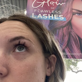 Amazing Lash Studio - Proof of severe lash fallout. - Eyelash Service Near Me - Waco, Texas