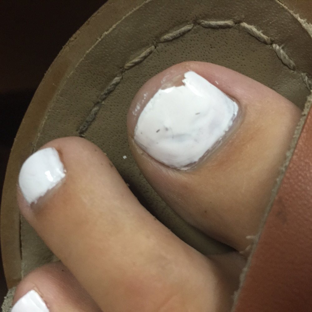 Bliss Nails & Spa - 2 days later... So lumpy! - Nail Salons Near Me - Chico, California Bliss Nails & Spa - 2 days later... So lumpy! - Nail Salons Near Me - Chico, California