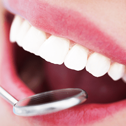Mission Mountain Dental