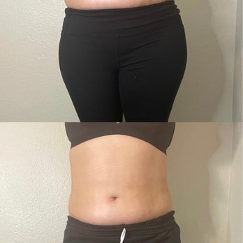 The Hourglass Method - Body Contouring Near Me - Placentia, California The Hourglass Method - Body Contouring Near Me - Placentia, California