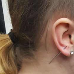 Body360 - Very professional, skilled and turned out great. They are swift and prepared so your anxiety isn't through the roof in anticipation.