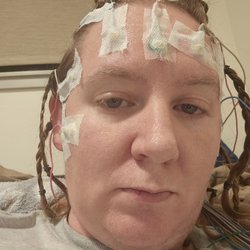 Orlando Epilepsy Center