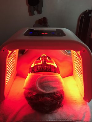 Facials - DIVINE JOURNEY FROM STUBBORN ACNE TO GLASS SKIN. Facials - DIVINE JOURNEY FROM STUBBORN ACNE TO GLASS SKIN.