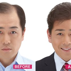 Jack Hair Designer - Before and after the hair weaving effect织发看后的效果图