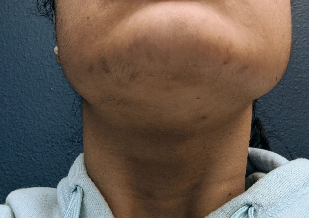 CALIFORNIA SKIN INSTITUTE SAN JOSELOS GATOS 17 Photos & 212 Reviews Dermatologists 2420