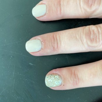 Sophia’s Nails  - Here's the scabs healing from the buffing. - Nail Salons Near Me - New Orleans, Louisiana