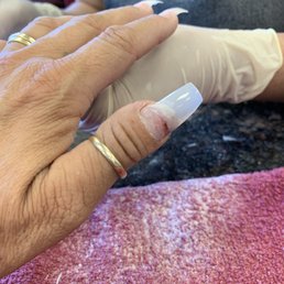 Removing old set, got my nail sliced off! Removing old set, got my nail sliced off!