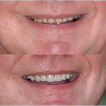 Robert G Dernick, DDS - General Dentistry Near Me - The Woodlands, Texas Robert G Dernick, DDS - General Dentistry Near Me - The Woodlands, Texas