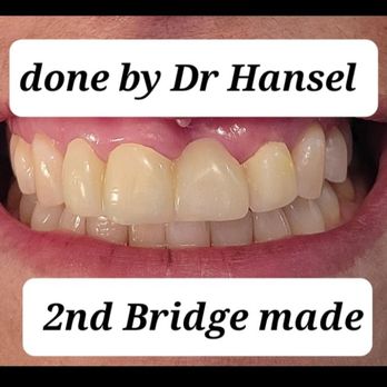 OraBell Dental Implant Centers - Cosmetic Dentists Near Me - Van Nuys, California OraBell Dental Implant Centers - Cosmetic Dentists Near Me - Van Nuys, California