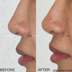 True Dermatology
