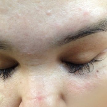 OC Lash Studio - 3 days in and most of them have fallen out. - Eyelash Service Near Me - Anaheim, California