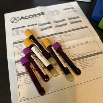 Single Poke - Kit blood collection - Laboratory Testing Near Me Single Poke - Kit blood collection - Laboratory Testing Near Me