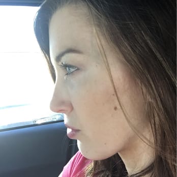 ORCHID - Completely smooth under eyes. So long sunken in zombie eyes! ;) - Medical Spas Near Me - Los Gatos, California ORCHID - Completely smooth under eyes. So long sunken in zombie eyes! ;) - Medical Spas Near Me - Los Gatos, California