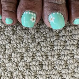 Poor nail design