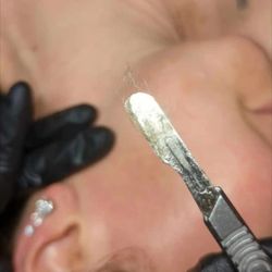 Bare Esthetics - dermaplane