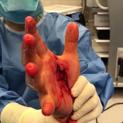 John J Fernandez, MD