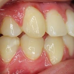 Rusty Jones Orthodontics