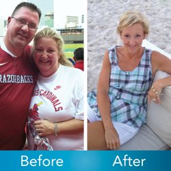 Roller Weight Loss & Advanced Surgery - Leecie Henson, "I have learned that, like life itself, this is a journey, but now I have a tool to help me face it with confidence."