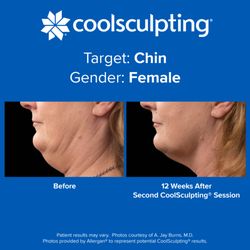 Dr. Sculpt CoolSculpting & EmSculpt Center