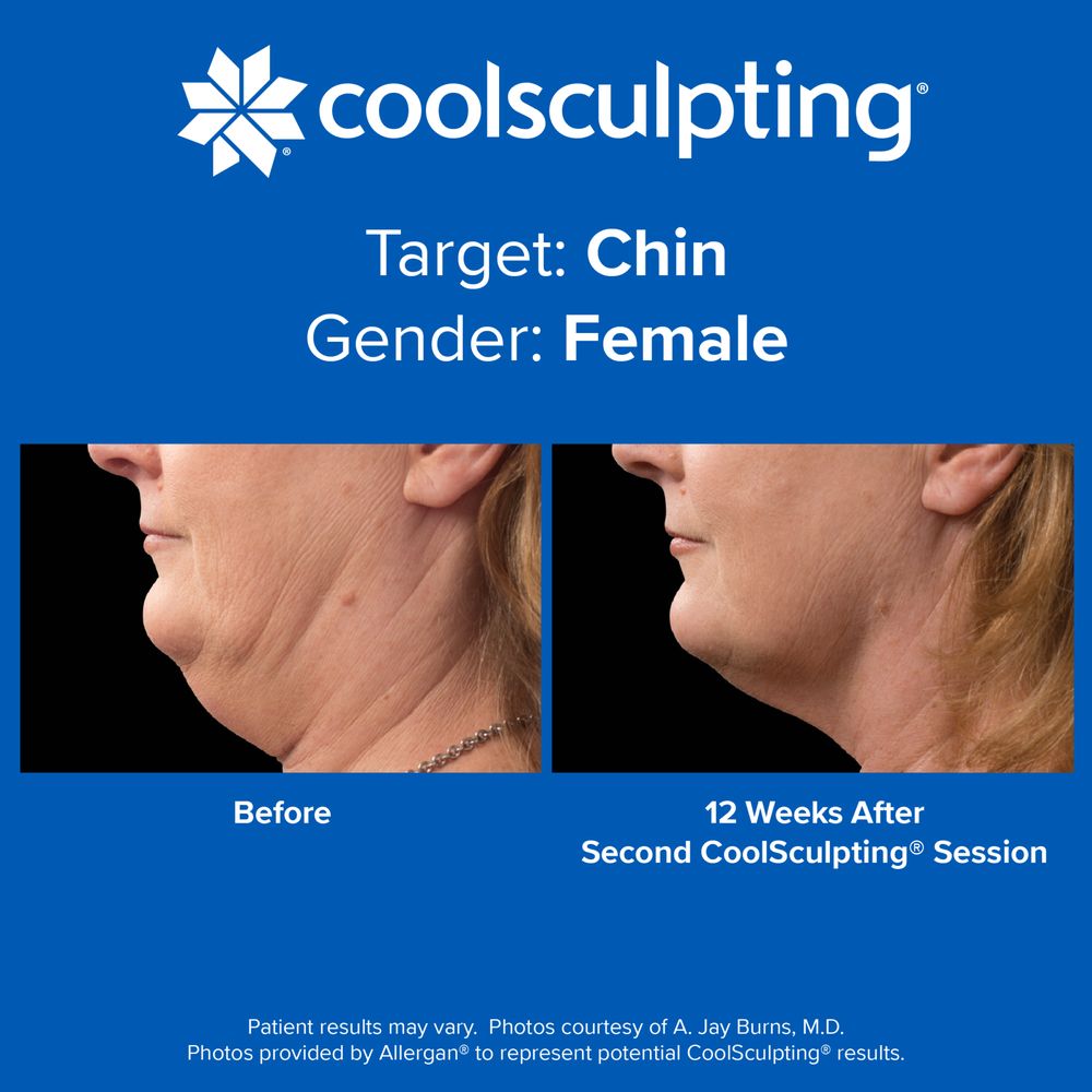 Dr. Sculpt CoolSculpting & EmSculpt Center Logo
