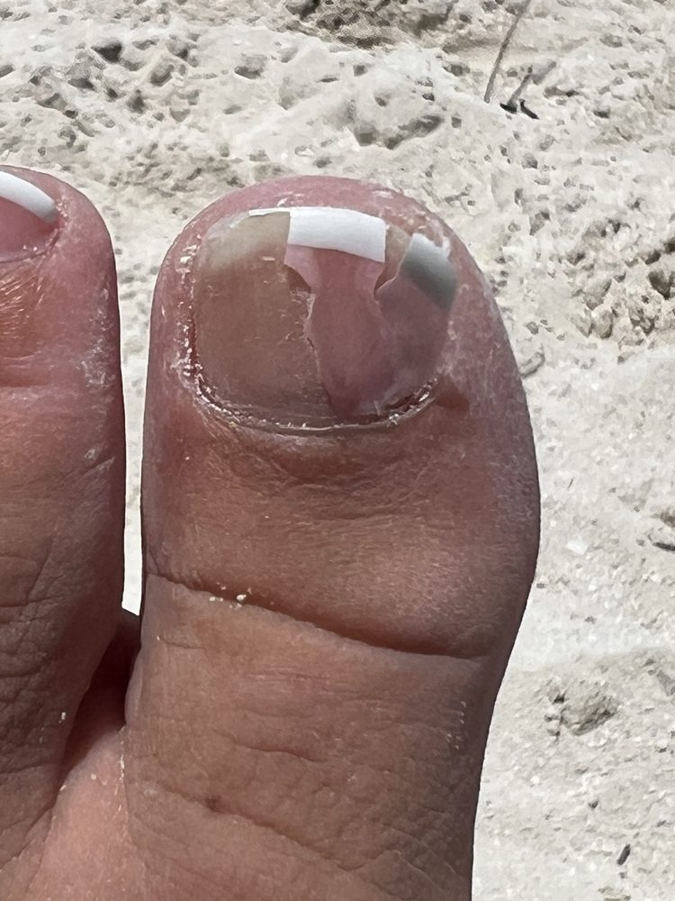 New Image Nails - How terrible does this look after THREE days?? - Nail Salons Near Me - Middletown, Delaware New Image Nails - How terrible does this look after THREE days?? - Nail Salons Near Me - Middletown, Delaware