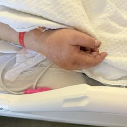 Workmen's Circle Multicare Center - Swelling of the hands n body