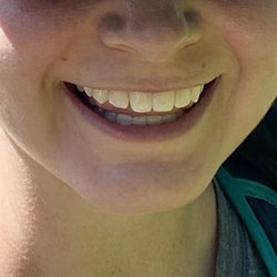 Columbia City Dental - Before