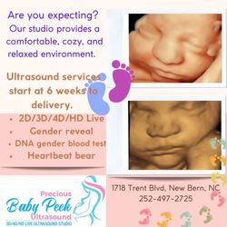 Precious Baby Peek Ultrasound