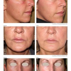 Lux Laser Medspa