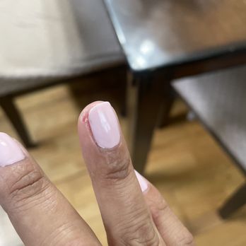 Vivian Nail Spa - Took a few days to heal - Nail Salons Near Me - Manassas, Virginia Vivian Nail Spa - Took a few days to heal - Nail Salons Near Me - Manassas, Virginia