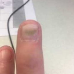 Pretty sure when your nails fall off your natural nail is NOT supposed to be green!!!!! Pretty sure when your nails fall off your natural nail is NOT supposed to be green!!!!!
