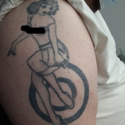 Fearless Tattoo Removal