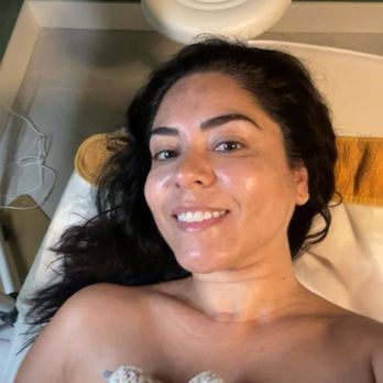 Whittier Springs Spa - After facial pic - Day Spas Near Me - Whittier, California Whittier Springs Spa - After facial pic - Day Spas Near Me - Whittier, California