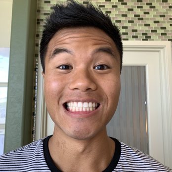 Sean Truong, DDS - After!! - Orthodontists Near Me - Westminster, California Sean Truong, DDS - After!! - Orthodontists Near Me - Westminster, California
