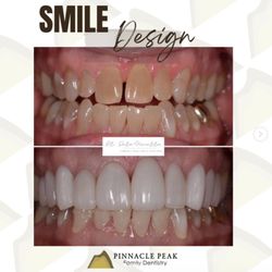 Pinnacle Peak Family Dentistry - You can count on us to create beautiful smiles!