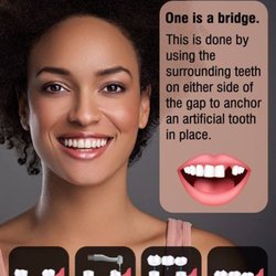 Washington Street Dentistry - Dental Crowns Indianapolis