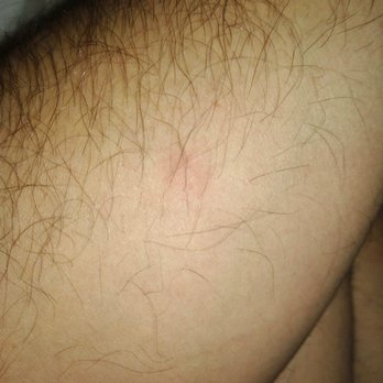 Murray Hotel - Bed bugs and bites - Hotels Near Me - Silver City, New Mexico