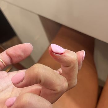 Lacquer Nails And Spa Tempe - my bloody nail after Liam started drilling and clipping at my cuticles when I came back the second time to get my nails fixed - Nail Salons Near Me - Tempe, Arizona Lacquer Nails And Spa Tempe - my bloody nail after Liam started drilling and clipping at my cuticles when I came back the second time to get my nails fixed - Nail Salons Near Me - Tempe, Arizona
