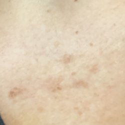 Seaside Dermatology & Skin Cancer Center