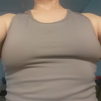 Solomon Cosmetic Center - The left breast that Dr Solomon squeezed is less volume than the right - Cosmetic Surgeons Near Me - Clearwater, Florida Solomon Cosmetic Center - The left breast that Dr Solomon squeezed is less volume than the right - Cosmetic Surgeons Near Me - Clearwater, Florida