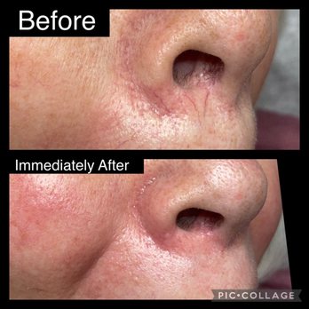 Gobare Aesthetic Studio - Laser Vein Treatment - Makeup Artists Near Me - Worcester, Massachusetts Gobare Aesthetic Studio - Laser Vein Treatment - Makeup Artists Near Me - Worcester, Massachusetts