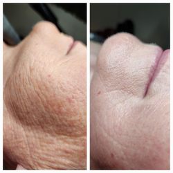 Urban Shades Skincare And Spray Tan - Before and After