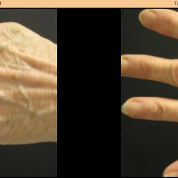 Midwest Laser Center - Tattoo Removal Near Me - Chesterfield, Missouri Midwest Laser Center - Tattoo Removal Near Me - Chesterfield, Missouri