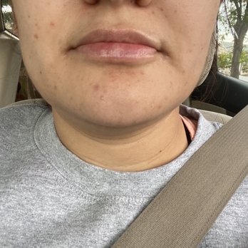 Cupertino Facial Esthetics - Cosmetic Dentists Near Me - Cupertino, California Cupertino Facial Esthetics - Cosmetic Dentists Near Me - Cupertino, California