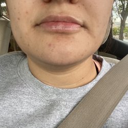 Cupertino Facial Esthetics