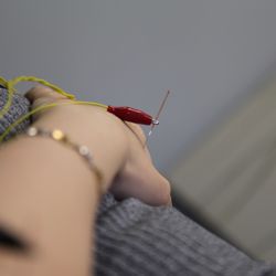 Back2Normal Physiotherapy - North Vancouver Vertigo
